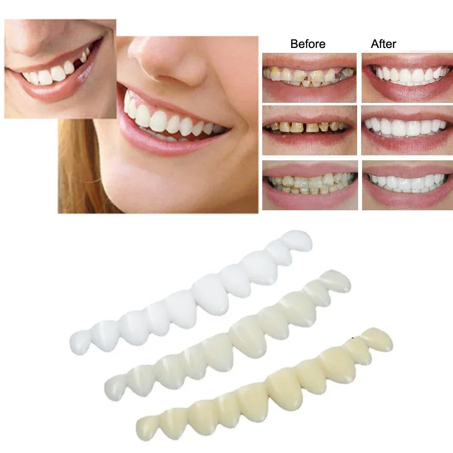 Instant Smile Multi-Shade Temporary Tooth Replacement Kit TEMP KIT For Missing Tooth