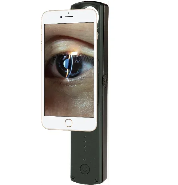 

Ophthalmic image New model Handheld Digital Ultra Portable Slit Lamp used with smartphone 6X magnificatioin price