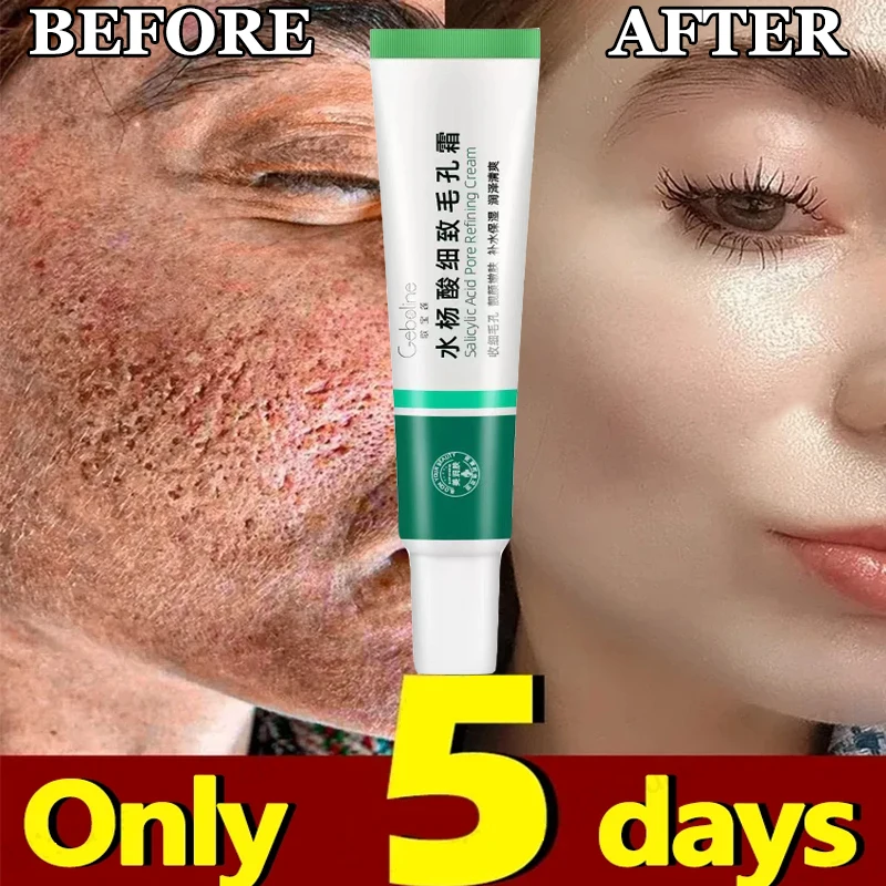 

Eliminate Large Pores Serum Salicylic Acid Pore Shrinking CreamRemove Blackhead Acne Repairing Tightening Skin Care Cosmetics