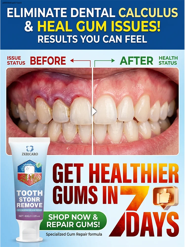 Tᴀʀɢᴇᴛ ᴀɴᴅ ʀᴇᴘᴀɪʀ ᴄᴀᴠɪᴛɪᴇs, ʀᴇᴍᴏᴠᴇ ᴘʟᴀᴏ̨ᴜᴇ,Make your smile more confident