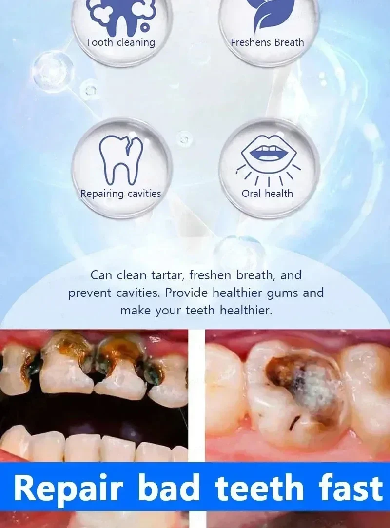 30g Teeth Whitening Anti-cavity Tooth Decay Fresh Bad Breath Repair Tooth Decay Remove Plaque Toothache Relieve Periodontitis