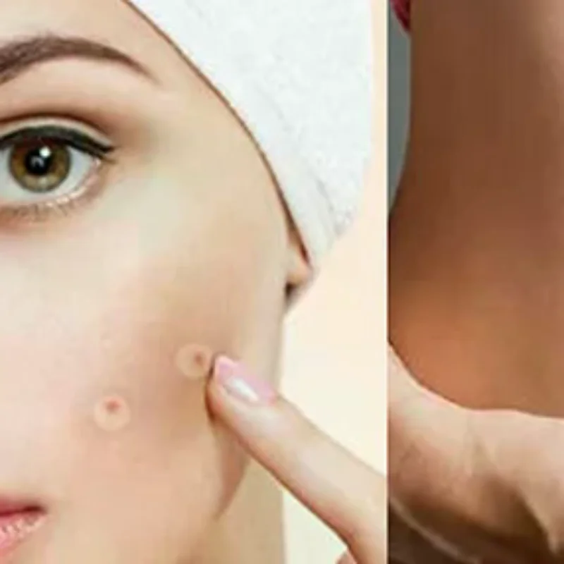 

Гидроколлоидный рулон для ухода за ранами Гидроколлоидные пластыри с самоклеящимися клеями, бинты от боли в кровати, высокопоглощающие