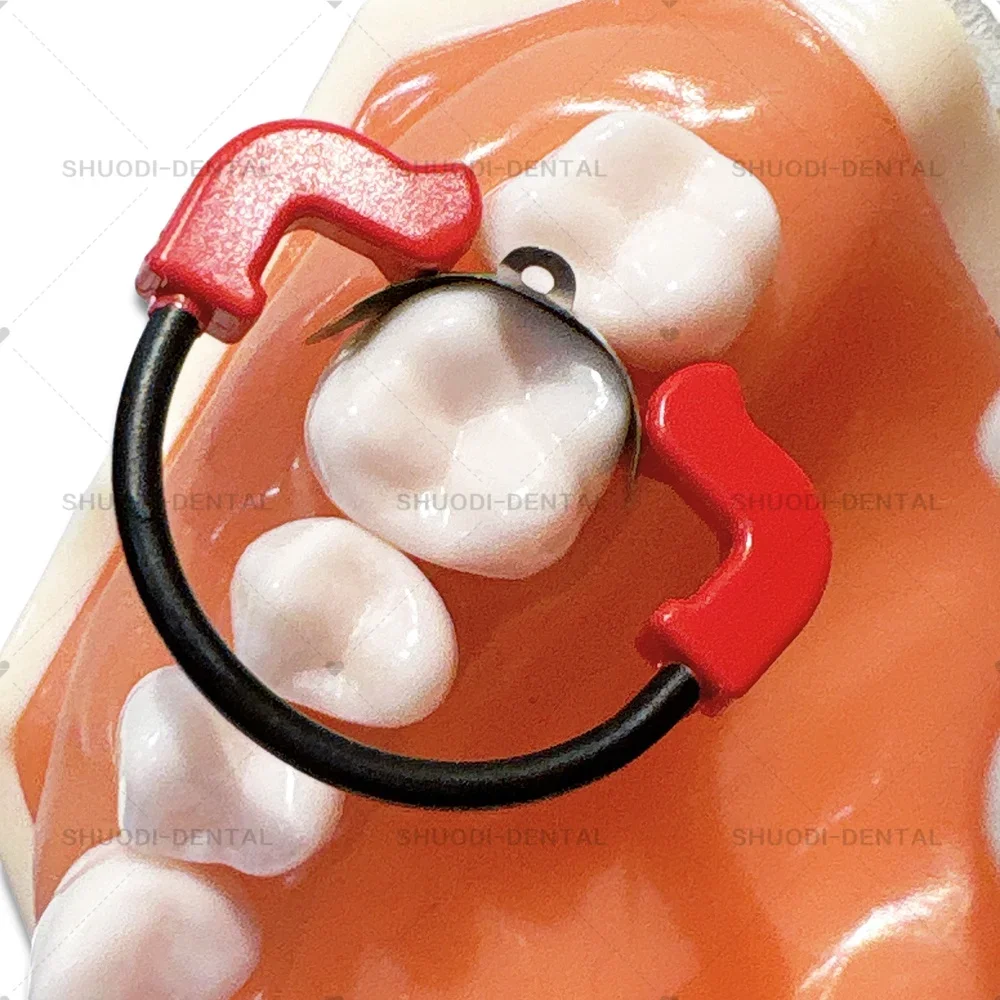 

H Lab Matrix System Set Контурные матрицы Peek and Niti Clip Ring Стоматологический инструмент Инструмент Матричные ленты Клиновый пластиковый комплект