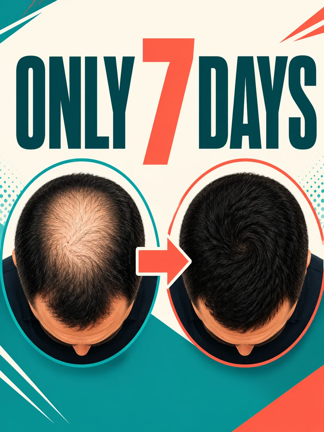 2026 New Upgrade Say Goodbye to the Look of Thinning Hair and Welcome a Fuller-Looking Crown Reduce Concerns About Appearance