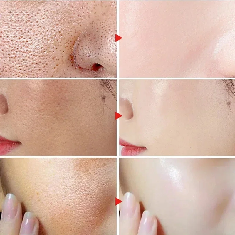 Crème de rétrécissement des pores à l'acide salicVAC, élimination rapide des grands pores, élimination des points noirs, resserrement du visage lisse, réparation, produits de soins pour la peau