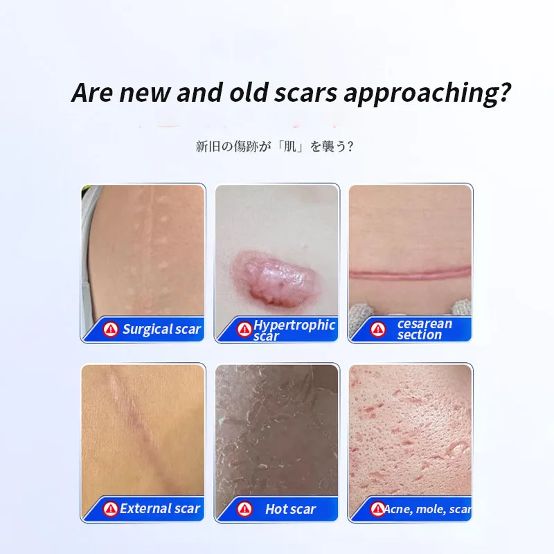 Lavender Scar Cream for External Use on Hypertrophic Scars, Post-Surgery Scars, Postpartum Scars, Burns, Old Scars, and Trauma Scars