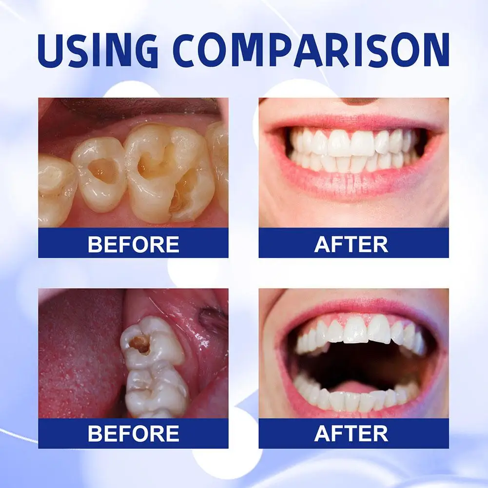 Blanchiment des dents, réparation de la carie dentaire, mauvaise haleine fraîche, anti-carie, suppression de la plaque dentaire, maux de dents, parodontite