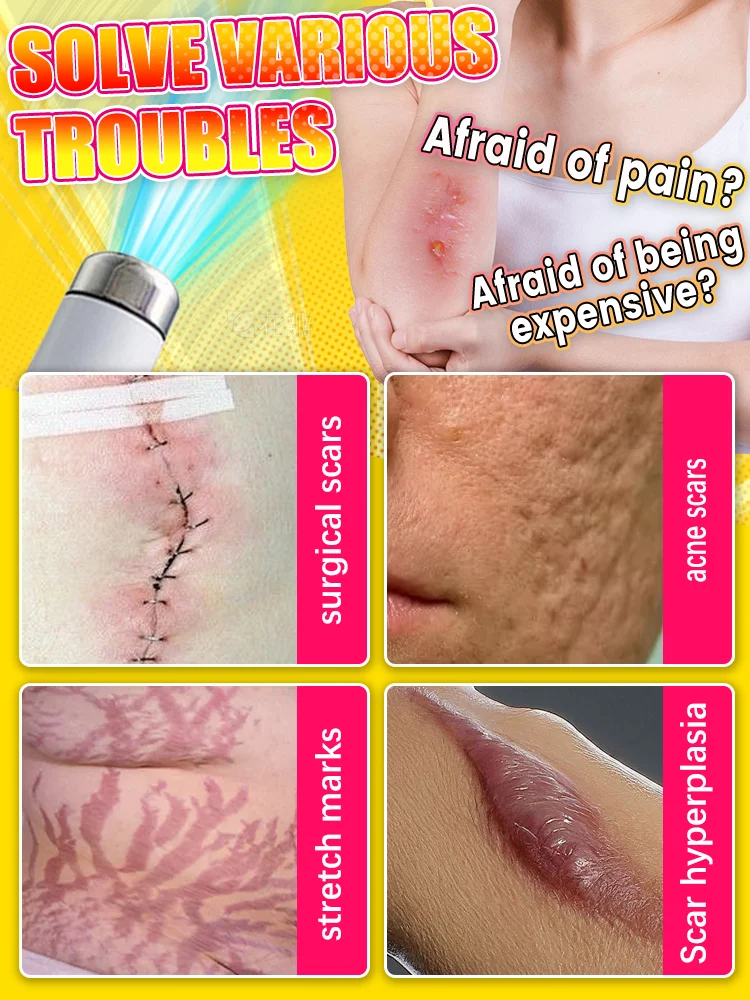 The latest laser equipment in 2025 will restore your skin to health!