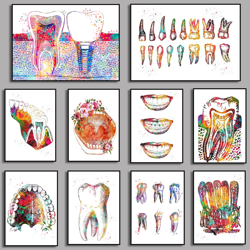 Implante Dental, impresiones de anatomía de dentista, lienzo, pintura de pared, póster de Arte Dental, imágenes artísticas de pared médica, decoración de clínica hospitalaria