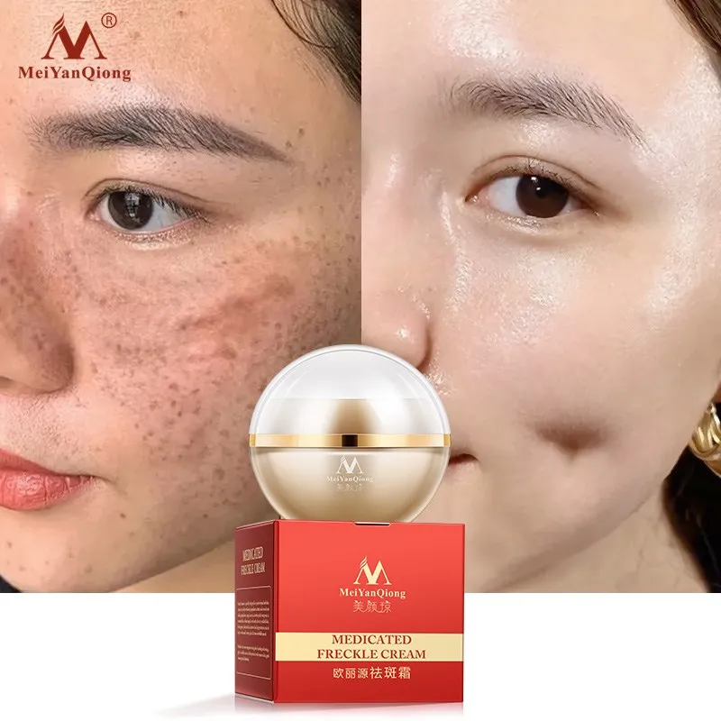 

Whitening Freckle Cream Remove freckles Nourishing skin care Improve dullness Brighten skin Firm face Skin repair Beauty care