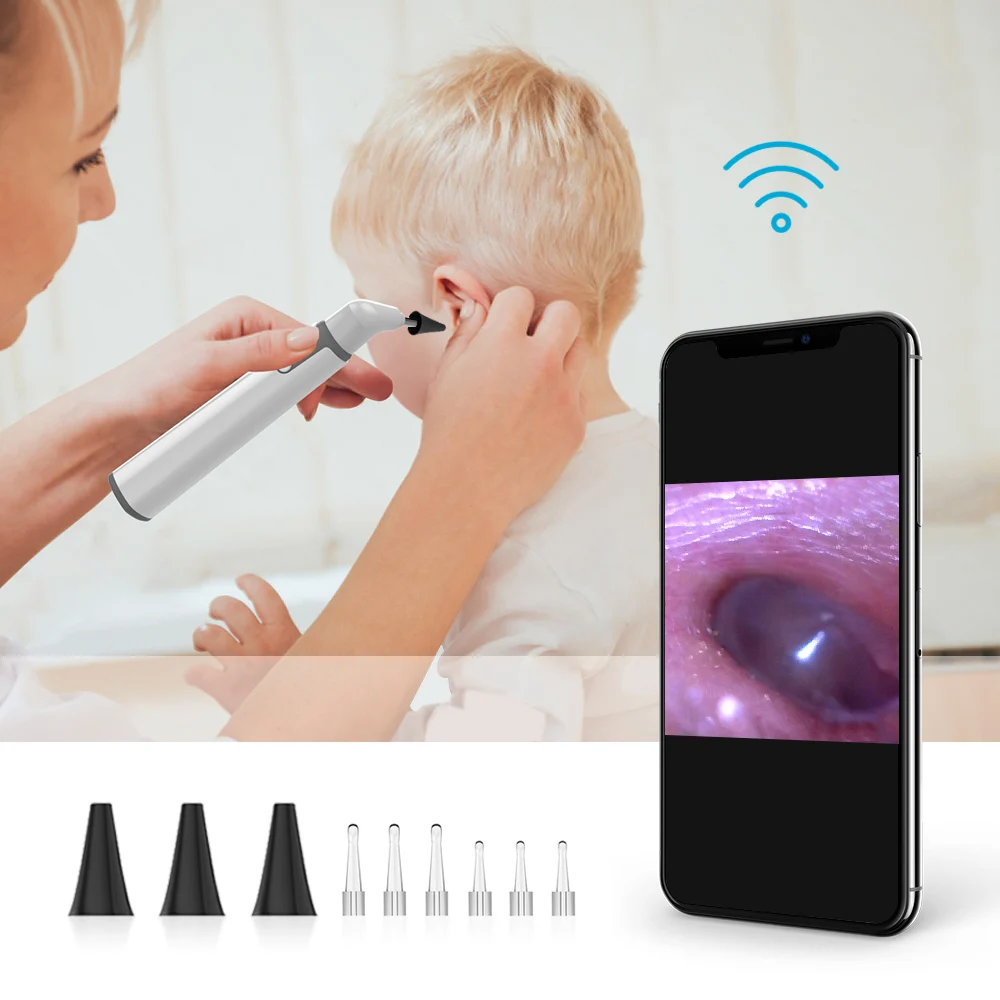 Imagem -04 - Wifi Orelha Otoscópio Inspeção Câmera Peças 2mp Digital Endoscópio Earwax Cleaner para Animais de Estimação Humanos Trabalhar com Android Iphone 3.9 mm