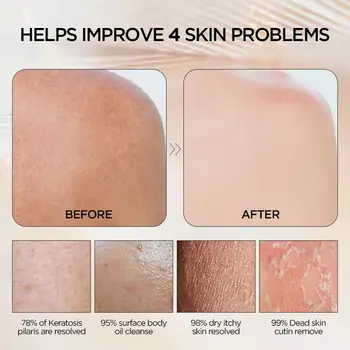 50 ks exfoliačních rukavic s vlastním logem do sprchy, měkké fialové exfoliační rukavice z viskózového vlákna, odstraňovač odumřelé a suché kůže 10 nejlepší prodej Korejská exfoliační rukavice - №4