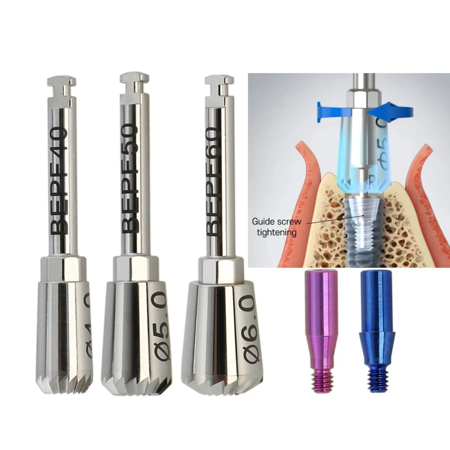 Implant ET Bone Profiler 4.0+5.0+6.0 & Guide Screws Mini Regular fit Hiossen