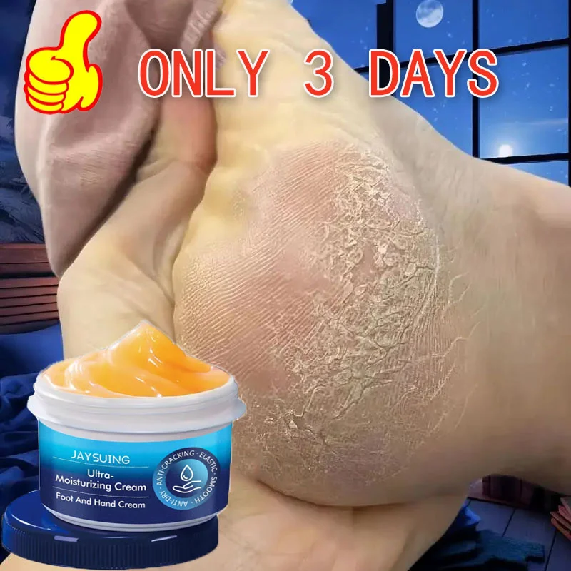 

Anti Crack Hand Foot Cream Anti-Drying Heel Cracked Repair Feet Mask Moisturizing Whitening Remover Dead Skin Feet Care Products