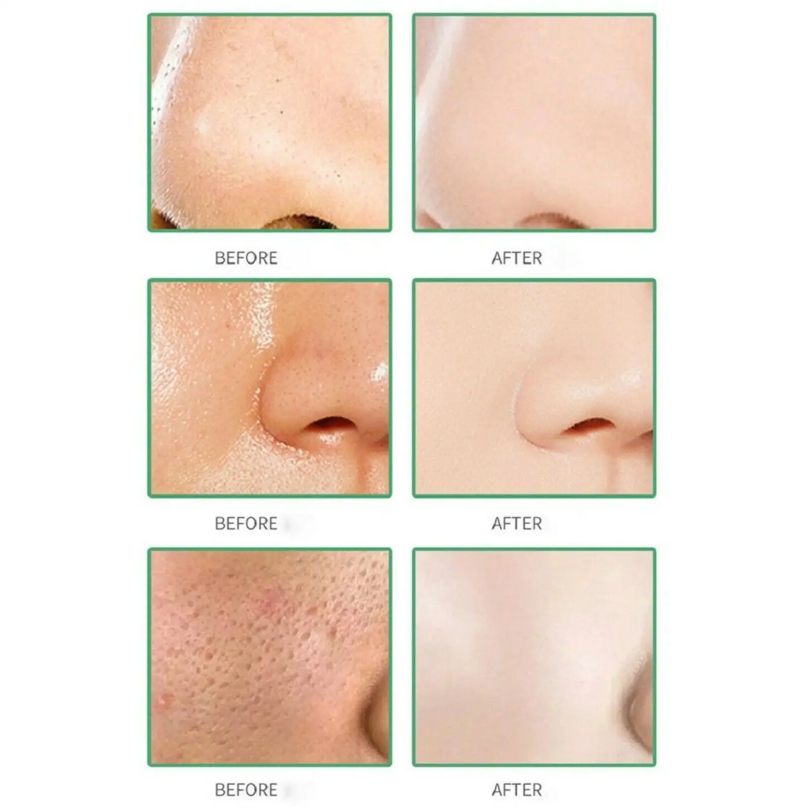 Crema reductora de poros, ácido salicílico, refinación de poros grandes, mejora el acné facial, elimina espinillas, antienvejecimiento, Control de aceite, 3 piezas