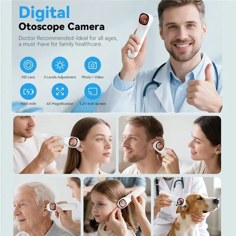 ABAG 1080P HD Otoscopio visivo digitale per orecchio 1.21 pollici Smart Visual Ear Wax Strumento pulito Supporto per scattare foto e video per l'orecchio del naso