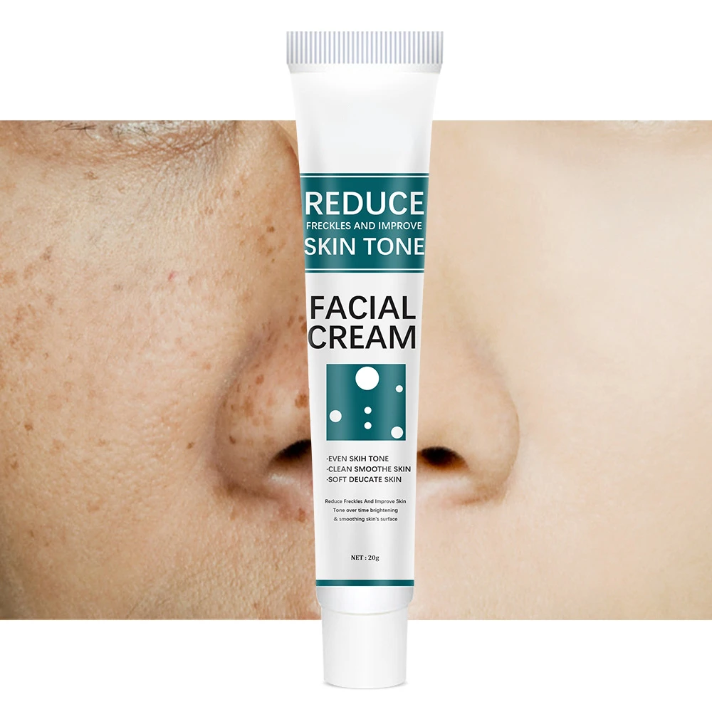 Effectieve Whitening Sproet Crème Verwijderen Donkere Vlek Crème Verwijdering Melanine Melasma Lighten Helderder Anti-Aging Huidverzorgingsproducten