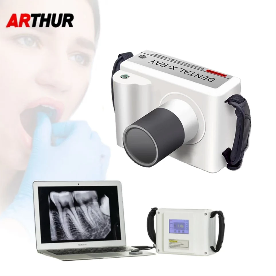 

Dental Portable Xray Camera Xray Machine Digital Vet Portable Dental equipment High Frequency Handheld