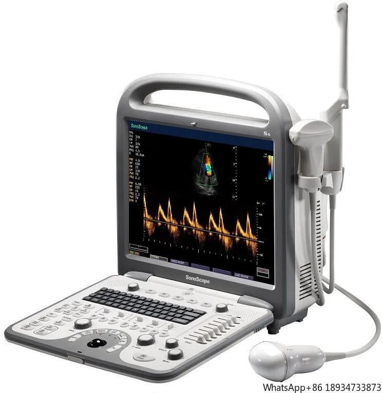 Echo china portable doppler ultrasound machine S8 for sale