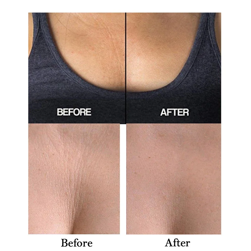 ใหม่ Anti-Wrinkle Chest Pads Reusable Chest Lift Patch Self-กาวคอ Pad ซิลิโคน Anti-Aging ริ้วรอย Remover Pad