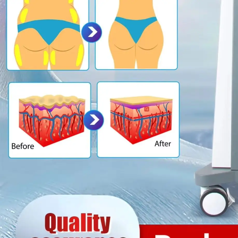 

RF EMS Body Sculpting TAIXL Machine 6500W Sculpt Stimulation Abdominal Burning Fat Slimming Electromagnetic Weight Loss