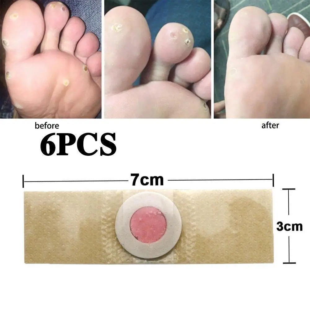 

6pcs Corn Remover Pads Toe Corn And Callus Removal Treatment Stickers Feet Treatment Adhesive Pads Toe Care Patches