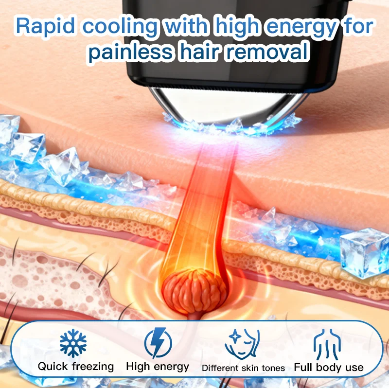 808nm 전문 미니 다이오드 레이저 제모기 빠른 플래시 제모기 무통 영구 제모기 전신 치료 여성