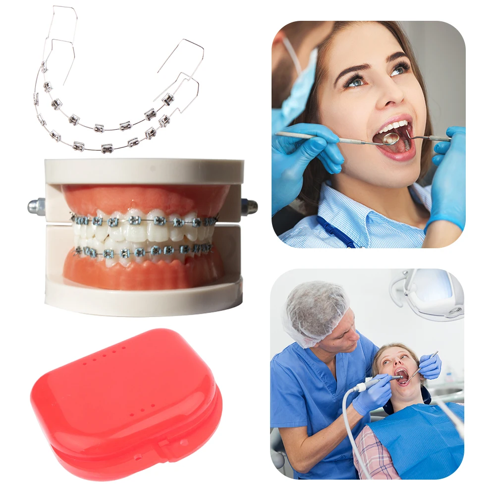 

1 Pair Orthodontic Ligature Ties with Storage Box Colored Dental Decor Braces Dental Fashion Decoration for Daily Tooth Protect