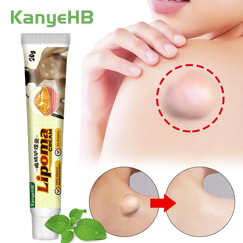 

1Pcs Lipoma Removal Cream Reduce Inflammation Treat Subcutaneous Lumps Fat Pack Remove Lipolysis Relieve Skin Swell Plaster G040