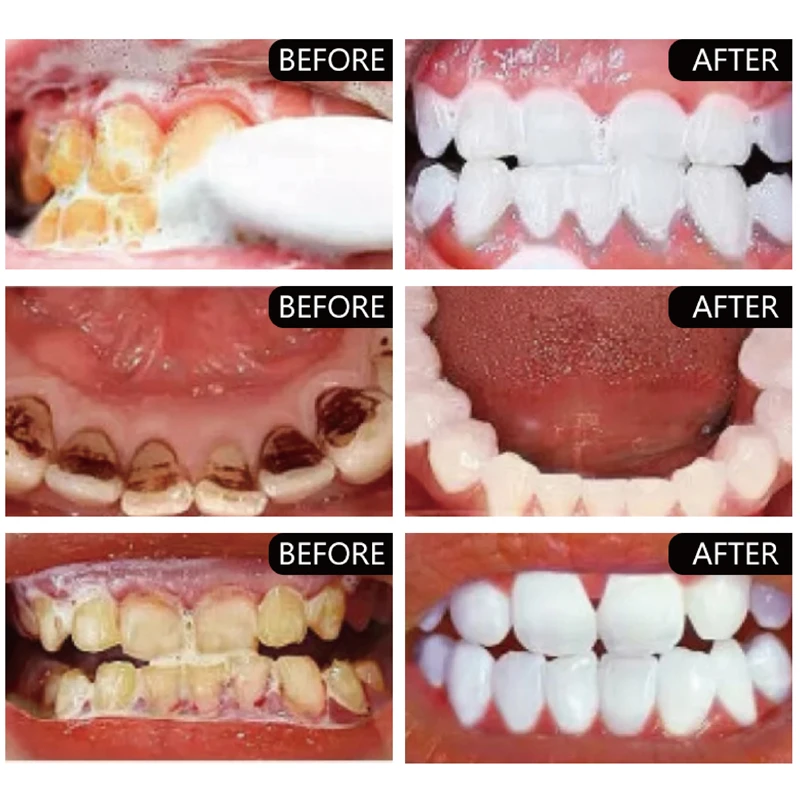 Polvere sbiancante per denti a base di erbe rimuovi macchie di placca dentifricio essenza per l'igiene orale pulizia cura dei denti strumenti per l'analisi 50g