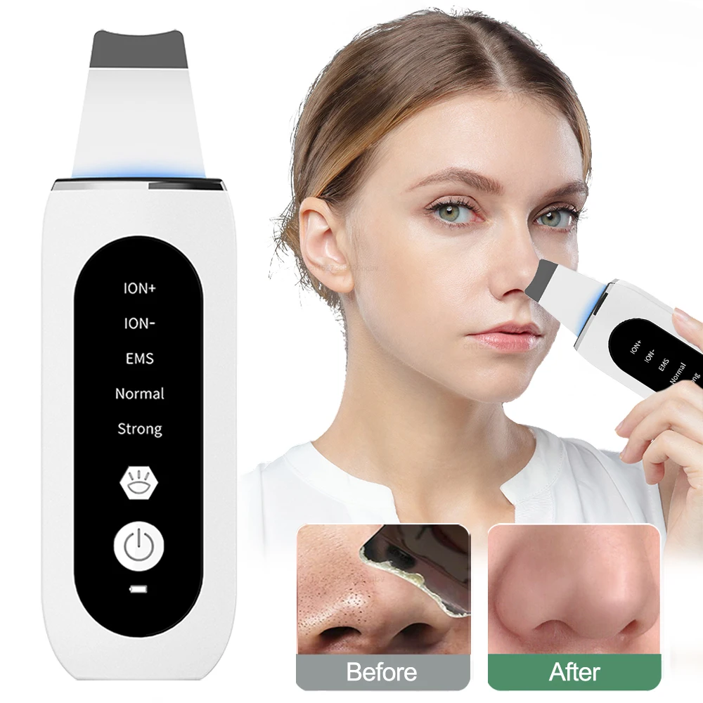 بالموجات فوق الصوتية الوجه الغسيل النقاط السوداء مزيل الرؤوس السوداء آلة تقشير الوجه بالموجات فوق الصوتية الجلد الغسيل حب الشباب المسام التنظيف العميق