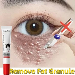 Crema para Ojos eliminadora de gránulos de grasa, antihinchazón, antiinflamatoria, Reduce las ojeras, líneas de decoloración, hidratante, cuidado de los ojos