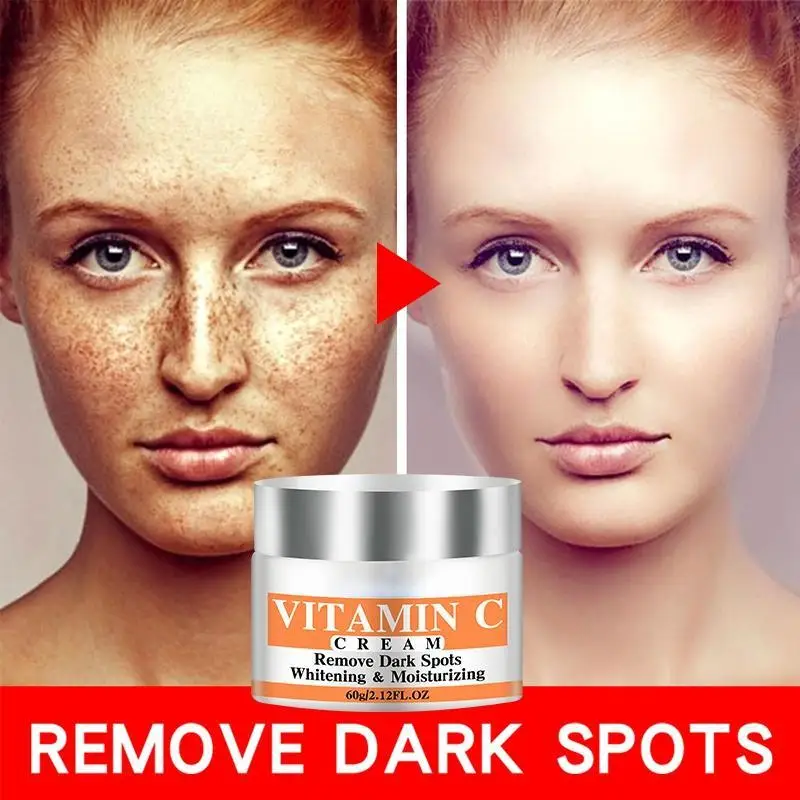 Mais novo vitamina c clareamento creme facial reparação fade sardas remover manchas escuras melanina removedor clareamento creme facial