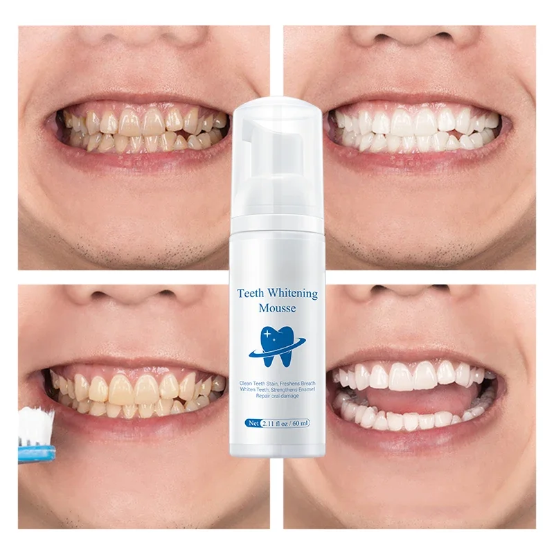 Teeth Whitening Mousse Tooth Whitening Cleaning White Teeth Oral Hygiene Toothpaste Bleaching Remove Stains Dental Tool