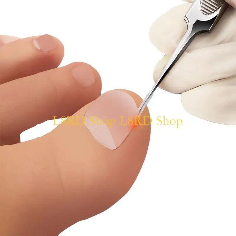 L8RD 10pcs/set Ingrown Toenail Correcting Tool Pain Care Ingrowing Corrector