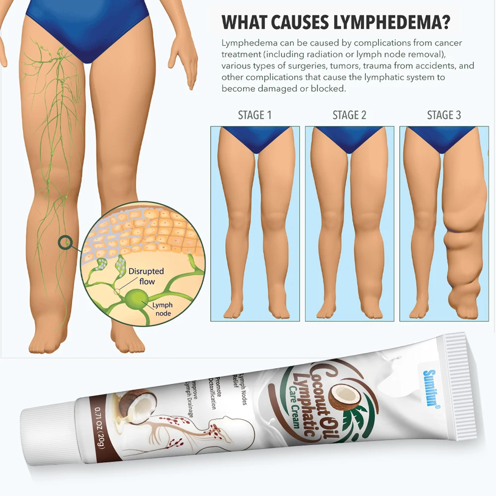 

Sumifun Lymphatic dredging Ointment Auxiliary breast neck lymph Node mammary gland Treatment Detox Cream Remove Nodes Plaster20g