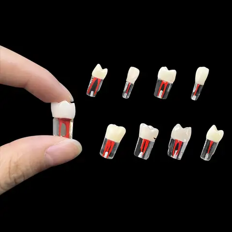치과 교육 모델 송진 근관 근관 근관 치료, 채우기 훈련 블록, RCT 연습 모델, 치과 의사 연구 학생, 1 개
