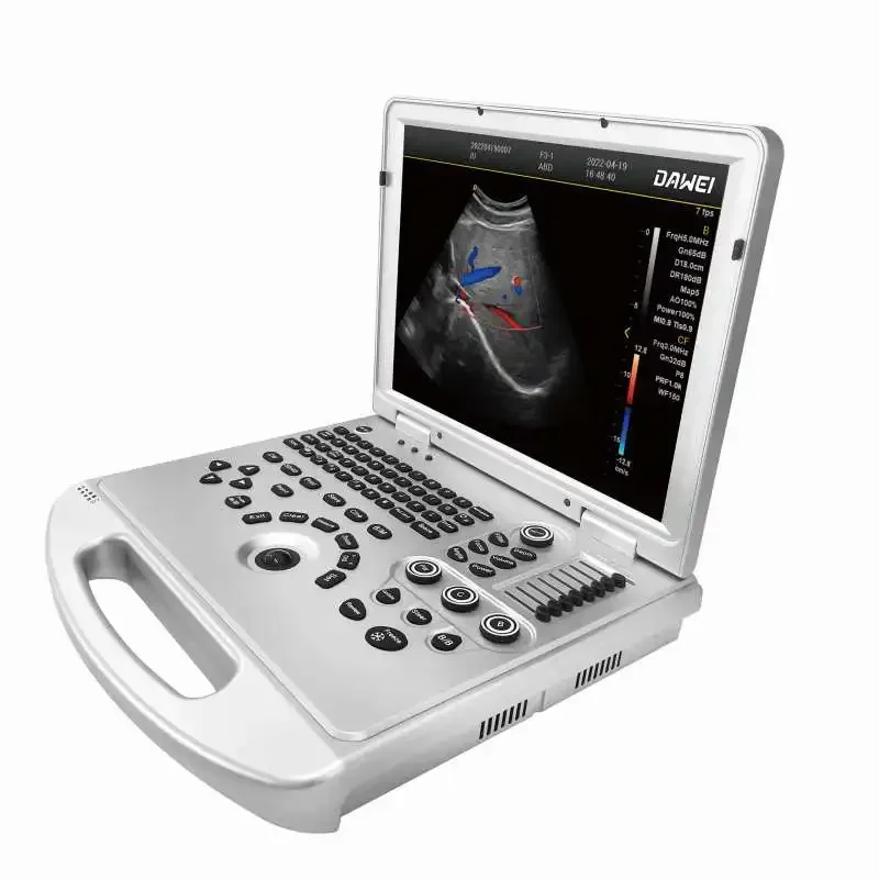 Full-Body Application Ultrasound DAWEI Discount Version