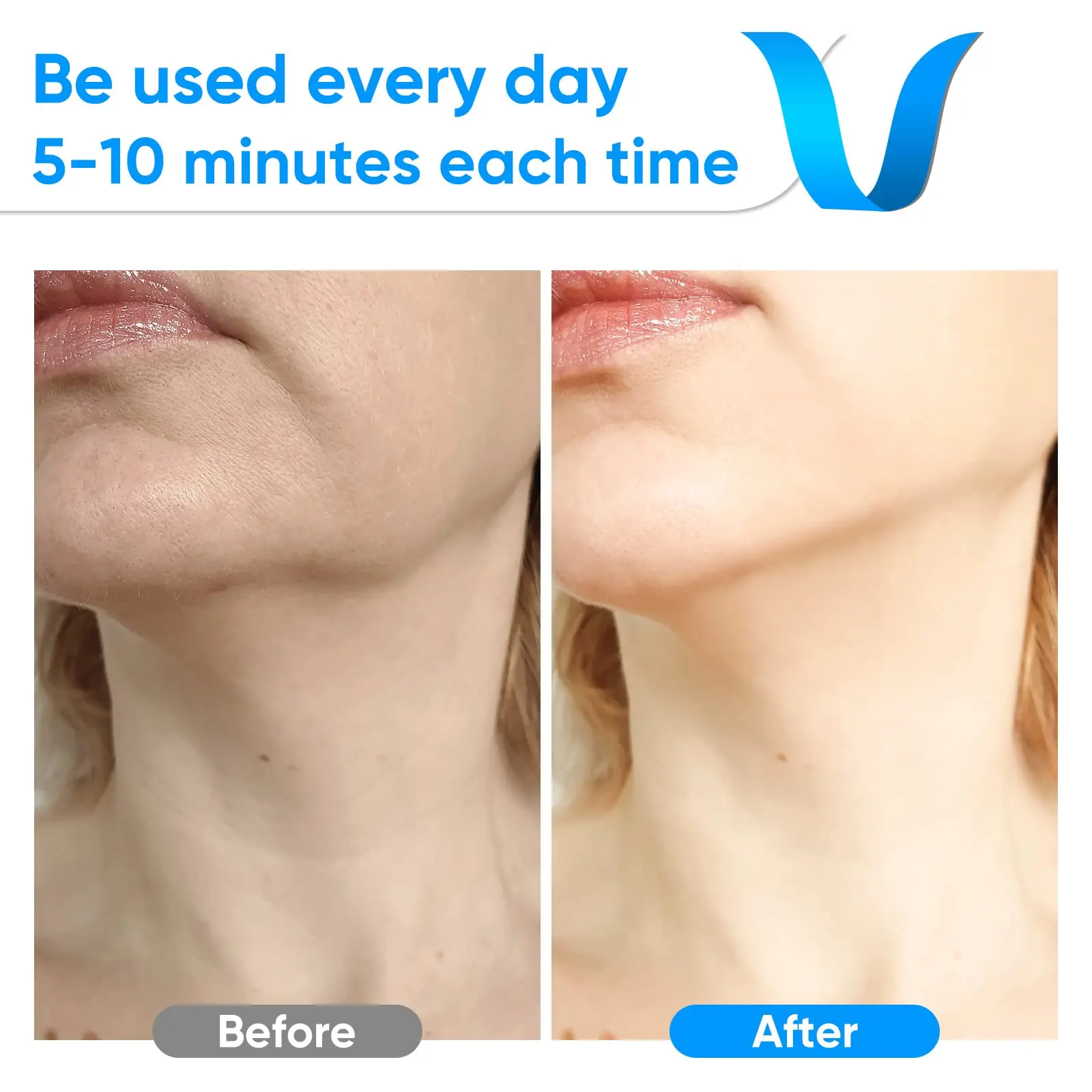 Masseur facial portatif masseur facial confortable appareil de beauté du visage et du cou pour les soins de la peau adultes hommes et femmes blanc