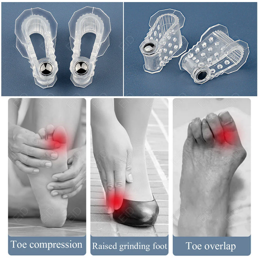 Magnet Orthopedic Foot Big Toe Straightener Hallux Valgus Bunion Corrector Orthotic Feet Bone Thumb Adjuster Correction Pedicure image 5