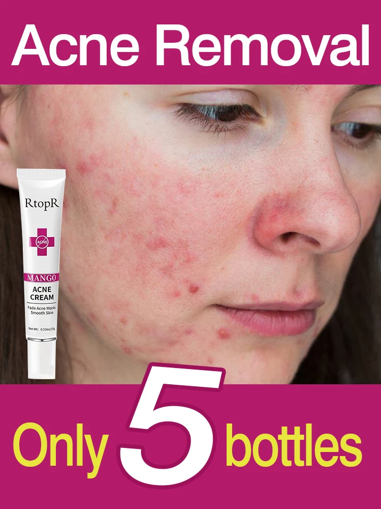 

Крем от акне, увлажнение, омоложение, Осветление кожи