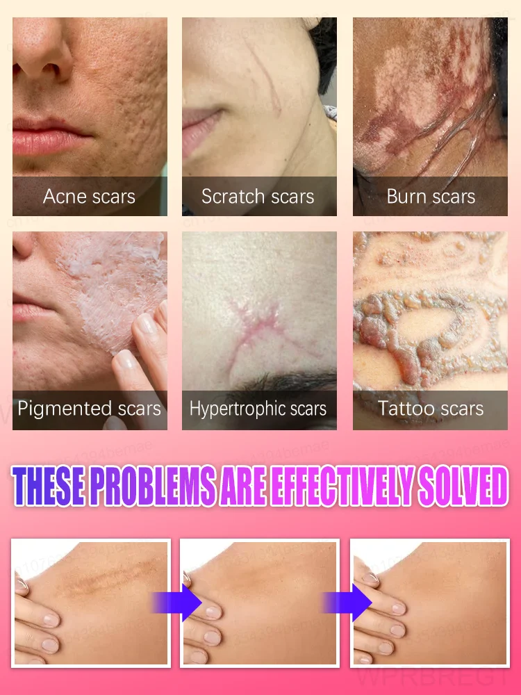 Do you want to have perfect skin?