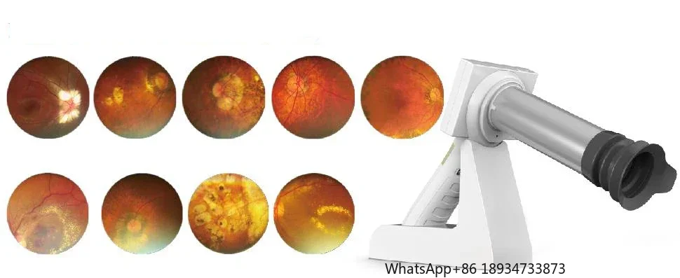 كاميرا شبكية رقمية محمولة باليد بدقة 42 درجة عالية الدقة لعام 2022 FC-100