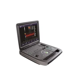 ALG-DU70 Portable  Color Doppler  Full digital 3D or 4D  laptop ultrasound scanner  Medical ultrasound  machine instruments