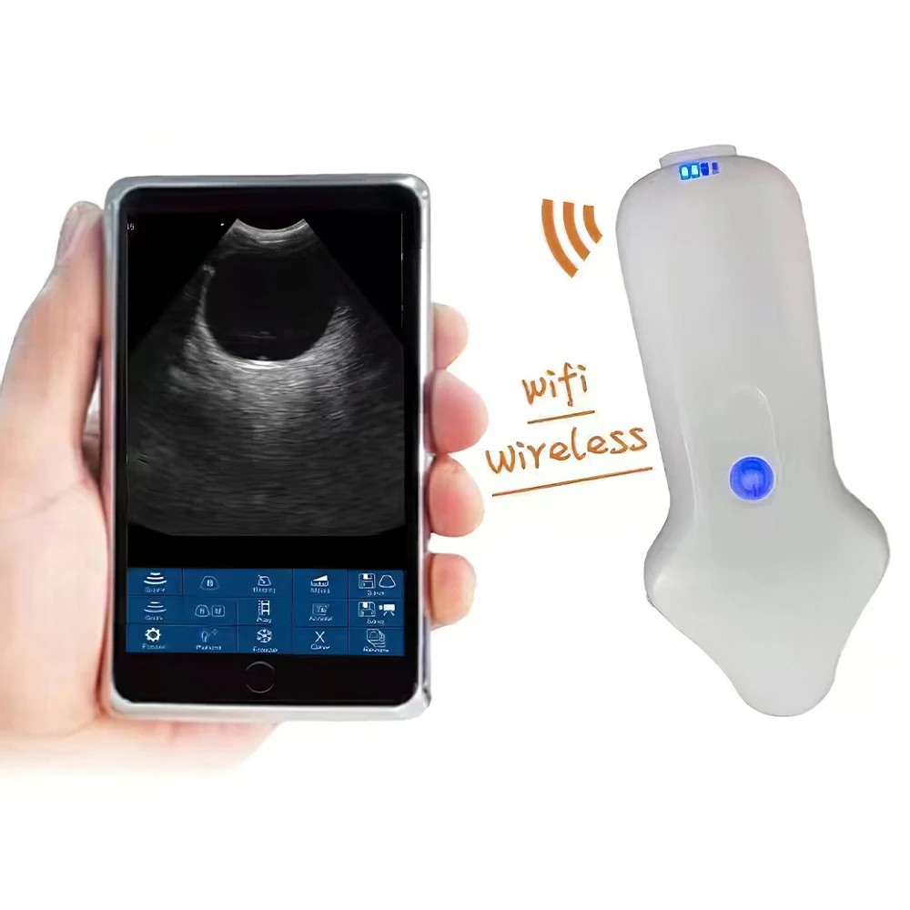 ΠΠ΅ΡΠΏΡΠΎΠ²ΠΎΠ΄Π½ΠΎΠΉ ΡΠ»ΡΡΡΠ°Π·Π²ΡΠΊΠΎΠ²ΠΎΠΉ Π·ΠΎΠ½Π΄ Π΄Π»Ρ Π³Π»Π°Π·, ΡΠ²Π΅ΡΠ½ΠΎΠΉ ΡΠ»ΡΡΡΠ°Π·Π²ΡΠΊΠΎΠ²ΠΎΠΉ Π΄ΠΎΠΏΠΏΠ»Π΅ΡΠΎΠ²ΡΠΊΠΈΠΉ Π°ΠΏΠΏΠ°ΡΠ°Ρ Π΄Π»Ρ ΠΎΡΡΠ°Π»ΡΠΌΠΎΠ»ΠΎΠ³ΠΈΠΈ, Π½Π΅ΠΎΠ½Π°ΡΠΎΠ»ΠΎΠ³ΠΈΠΈ, ΠΌΠ΅Π»ΠΊΠΈΡ
Π΄ΠΎΠΌΠ°ΡΠ½ΠΈΡ
ΠΆΠΈΠ²ΠΎΡΠ½ΡΡ
ΠΠ΅ΡΠΏΡΠΎΠ²ΠΎΠ΄Π½ΠΎΠΉ ΡΠ»ΡΡΡΠ°Π·Π²ΡΠΊΠΎΠ²ΠΎΠΉ Π·ΠΎΠ½Π΄ Π΄Π»Ρ Π³Π»Π°Π·, ΡΠ²Π΅ΡΠ½ΠΎΠΉ ΡΠ»ΡΡΡΠ°Π·Π²ΡΠΊΠΎΠ²ΠΎΠΉ Π΄ΠΎΠΏΠΏΠ»Π΅ΡΠΎΠ²ΡΠΊΠΈΠΉ Π°ΠΏΠΏΠ°ΡΠ°Ρ Π΄Π»Ρ ΠΎΡΡΠ°Π»ΡΠΌΠΎΠ»ΠΎΠ³ΠΈΠΈ, Π½Π΅ΠΎΠ½Π°ΡΠΎΠ»ΠΎΠ³ΠΈΠΈ, ΠΌΠ΅Π»ΠΊΠΈΡ
Π΄ΠΎΠΌΠ°ΡΠ½ΠΈΡ
ΠΆΠΈΠ²ΠΎΡΠ½ΡΡ