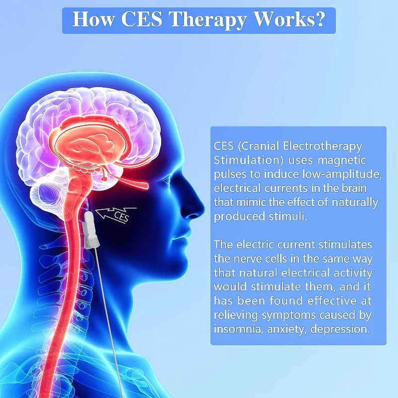CES Cranial Electrotherapy Ear Clip, Sleep Aid Device for Fast Sleep, Relieve Insomnia Sleepless Anxiety Head Pain