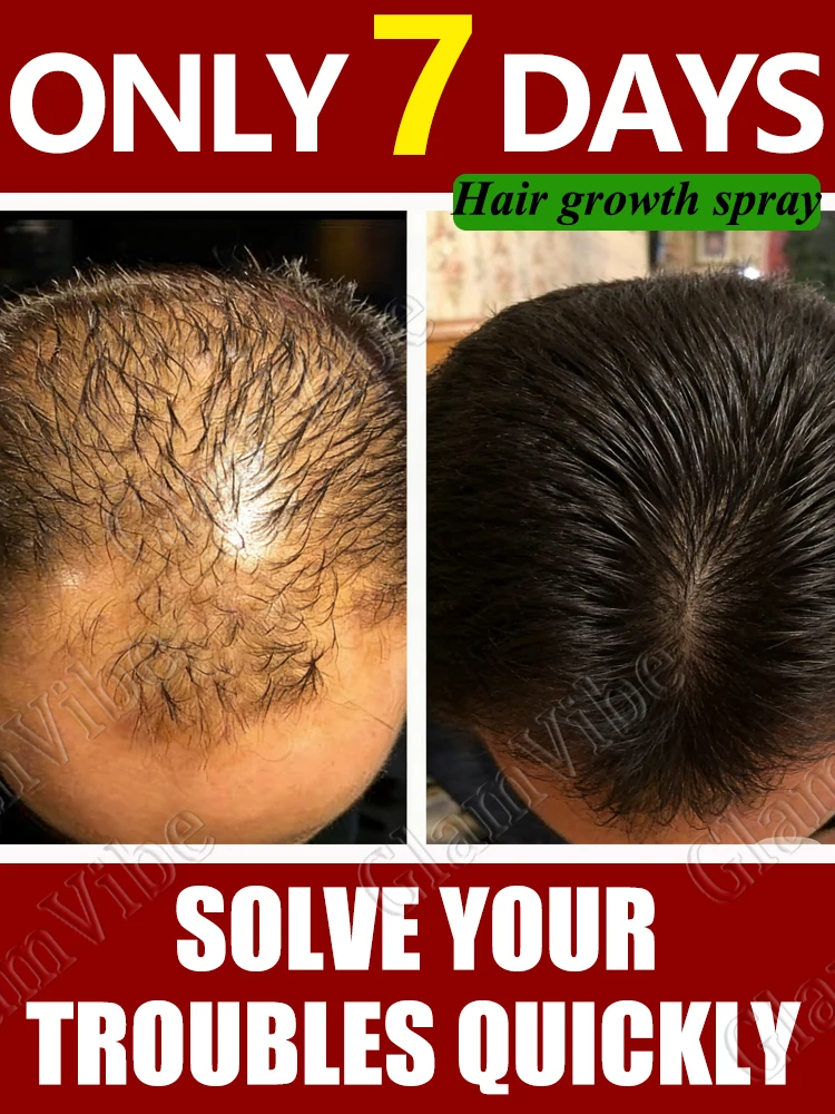 

Nᴏᴜʀɪsʜ ᴅʀʏ ʜᴀɪʀ, promote upward ɢʀᴏᴡᴛʜ from 0 to 1.