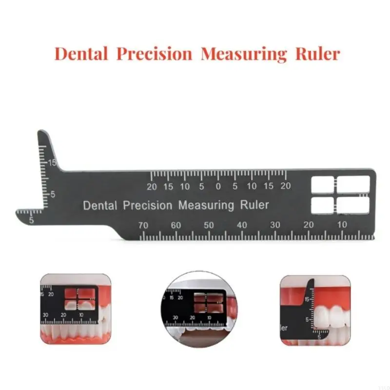 Aluminum Dental Measuring Ruler Small Dental Precisions Measuring Ruler Clear Scale for Professional Dental Procedures