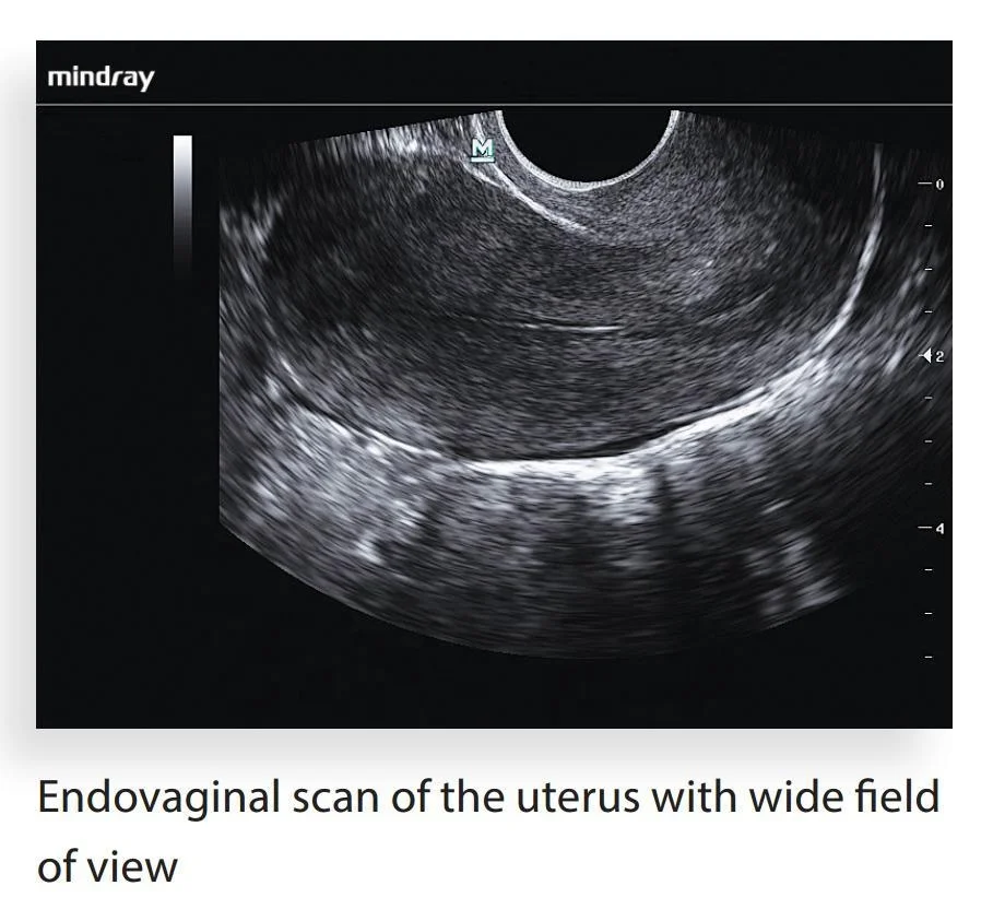 Mindray M7 Ultrasound For Sale