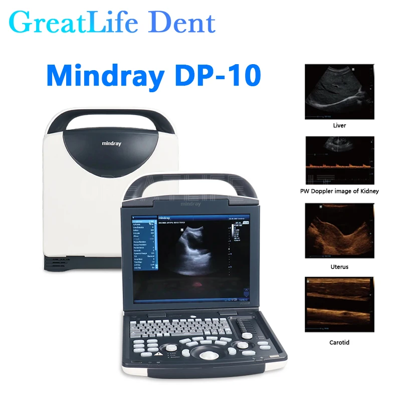 GreatLife Dent Mindray DP-10 Black and White Portable B-ultrasound Therapy Scanner Machine Abdominal Probe 35C50EB